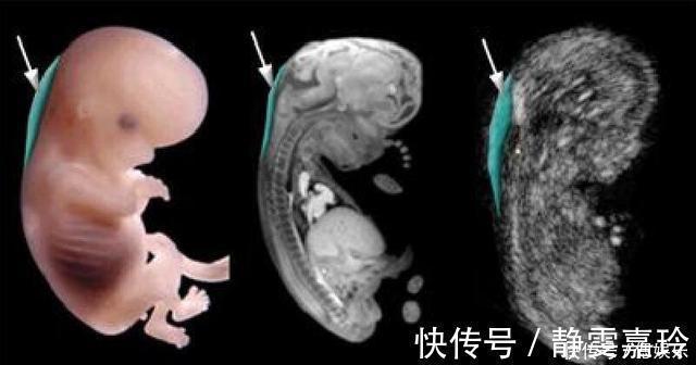 排畸|“胎儿畸形”危险期：过了这个月份，孕妈就可以把心放肚子里了