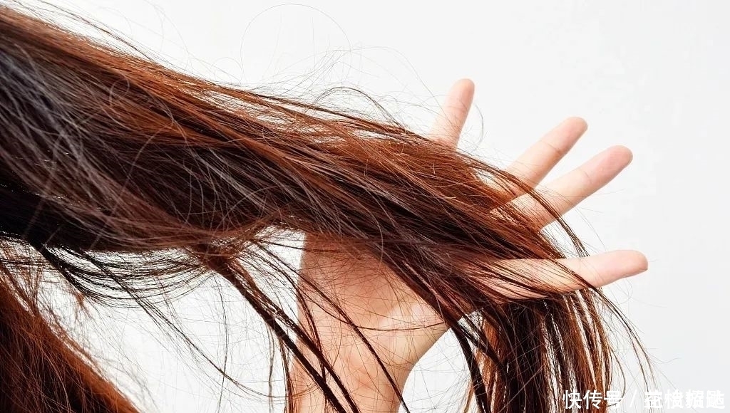 头皮|这4种错误的洗头方式,让你的头发越掉越多!