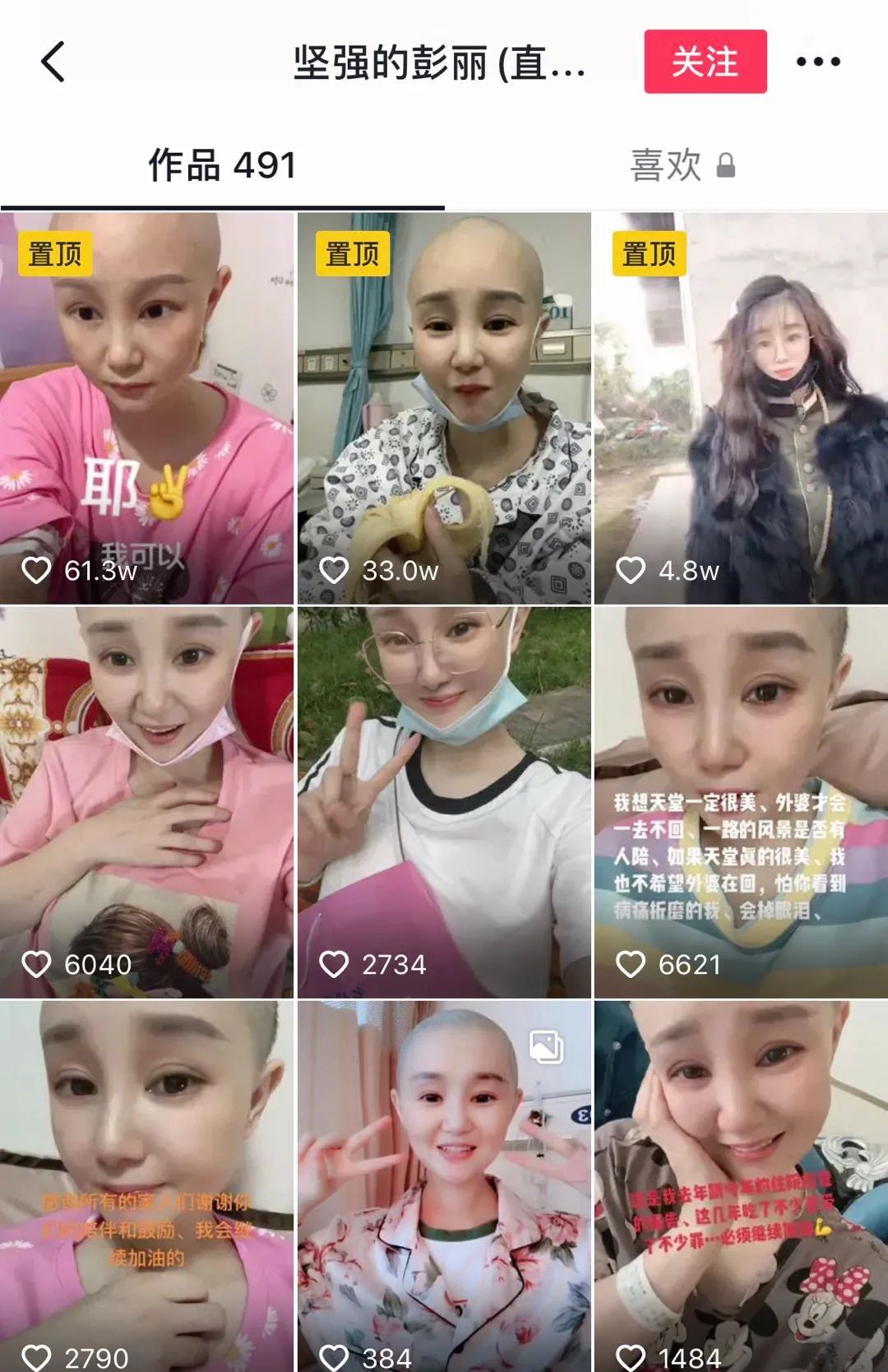 化疗|32岁湖北姑娘患肺癌4年，拍500条“抗癌日记”，最大的心愿就是能活到60岁