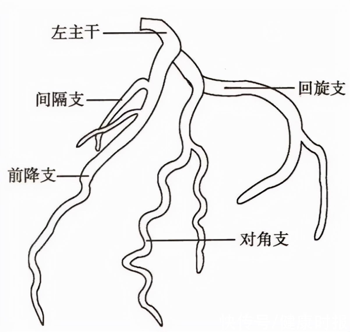 心肌梗死|九死一生！这位司机血管堵了，他的一个决定救了自己