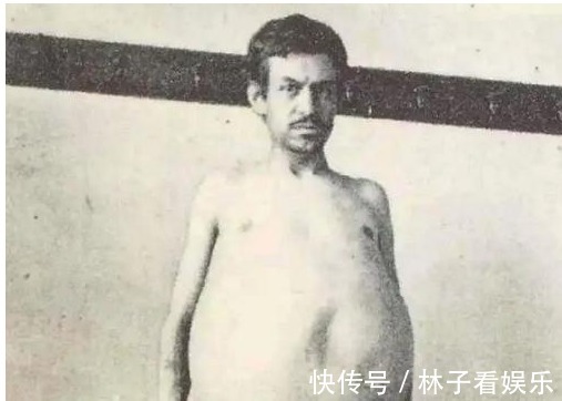 游客|他三年没上大便活活憋死,巨型大肠被放博物馆展览,吸引百万游客