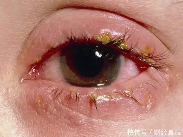 身体|养肝“冠军”并非苦瓜,经常吃,肝更有活力,身体显年轻