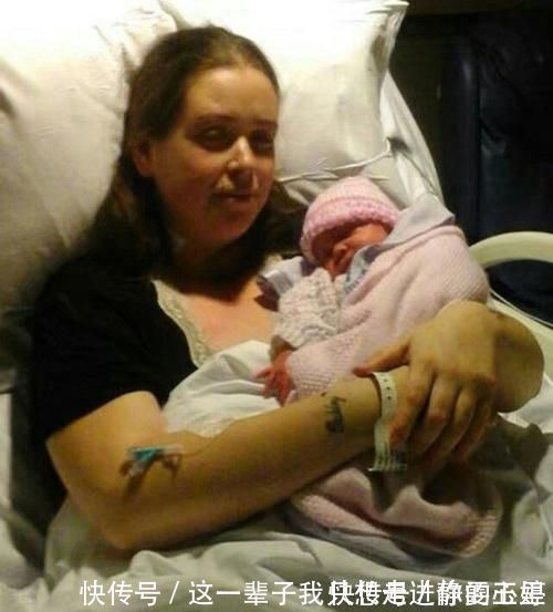 孩子|生下孩子醒来却发现自己的腿不见了!这是什么操作!