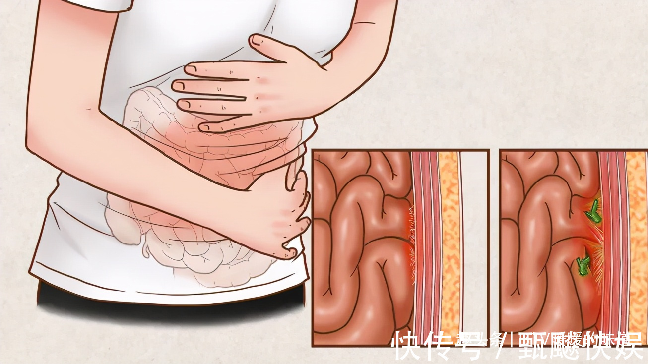 菌菇|便秘最怕4种食物!隔三差五吃一次,比香蕉都管用清肠还排毒