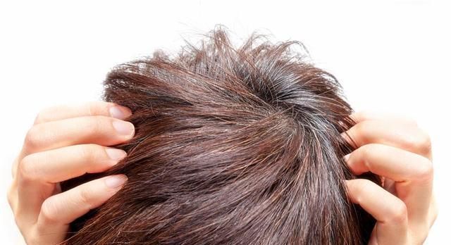 微量元素|长白头发，真只是缺维生素导致的？专家：这几点也有可能导致白发