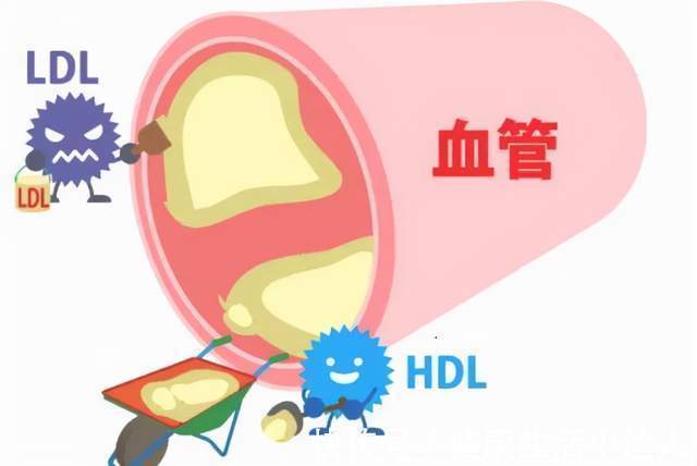 吸烟者|血脂异常:超4亿国人的困扰,睡觉时有3个表现,多半已中招