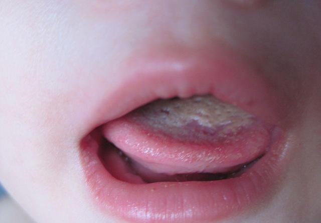 胜过|想要孩子长得高,“天然增高剂”要多吃,补钙胜过牛奶和骨汤