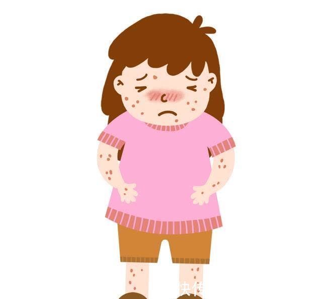 症状|“胎毒”是什么?有必要去“胎毒”吗?