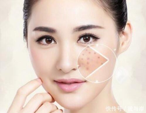 辣椒是留痘印的“罪魁祸首”?不敢吃辣椒的人都过来看看吧