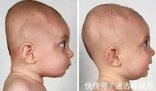 宝妈|孩子刚出生就给枕枕头,导致头型太难看,医生询问原因后无奈摇头