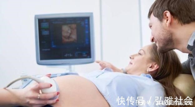 测量|孕期B超单直接反应胎儿状况,这5处孕妈要学会看懂,医生不会详说