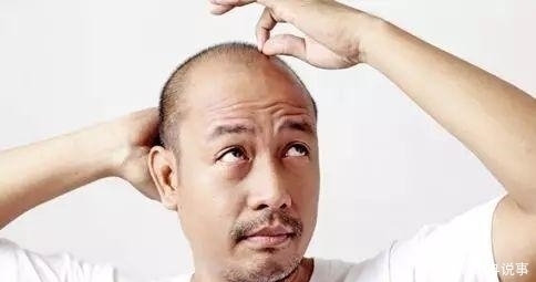 衰老|男人老不老, 这5个表现看了就知道, 尤其第1个, 一点都藏不住