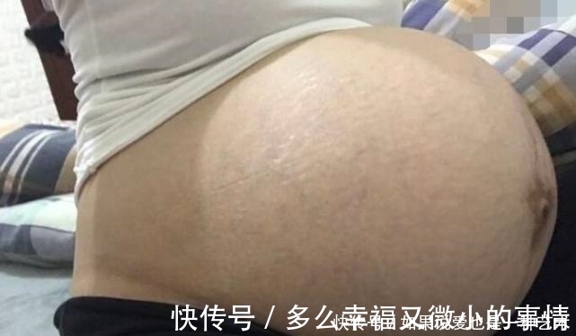 孕晚期|怀孕晚期，如何判断“要生了”？3个方法要牢记，别把孩子生家里