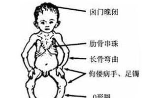 你缺乏维生素D吗?专家:缺维生素D有此些危害,别忽视了
