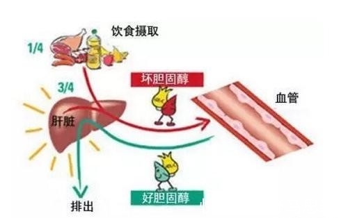 甘油三酯升高|高血脂不能吃什么 日常饮食高血脂不能吃什么