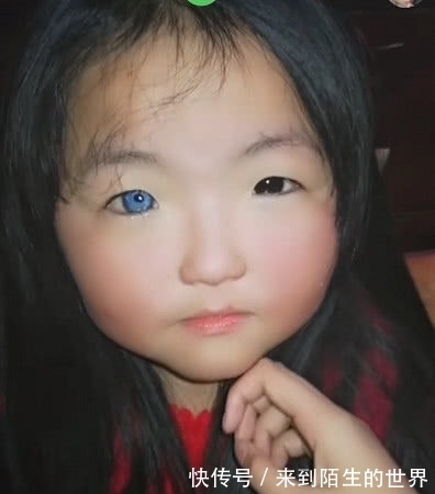 异瞳|奇闻:小萝莉天生“异瞳”,当她睁开眼的瞬间,感受到二次元气息
