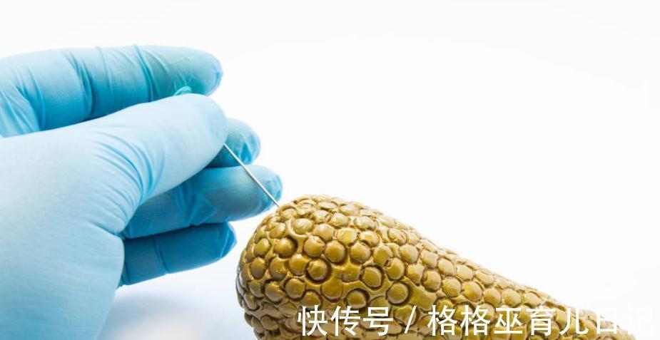 难度系数|什么癌症最“难缠”?这4种癌症,理应“榜上有名”