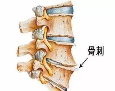 颈椎遇到化铁化剌方也得避让,一个快要失传的化剌方,让你的颈椎灵动自如