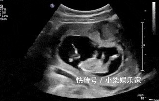 鬼主意|孩子有这三个“坏习惯”,预示“双商高”,家长就偷着乐吧!