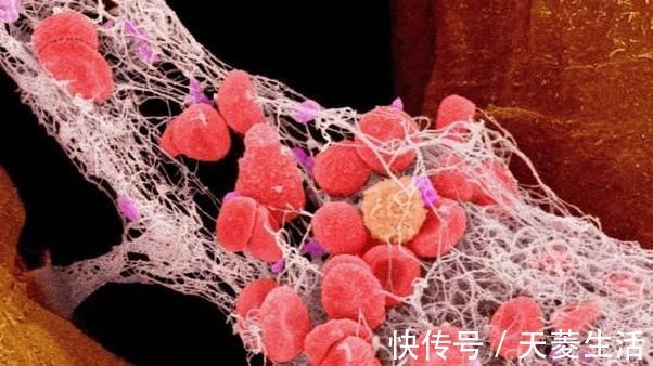 血液粘稠|血液的“稀释剂”找到了,饭后喝上一口,净化血液,血栓绕道走