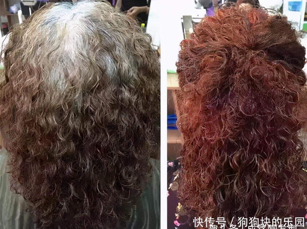 老年人|老年人白发多能用植物染发剂吗?对发质有伤害吗?能遮盖白发吗?