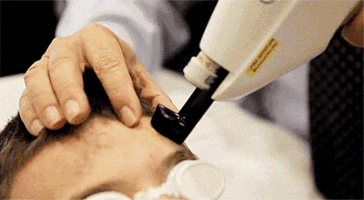 爱豆们竞当医美达人？男性适合的轻医美项目top5合集