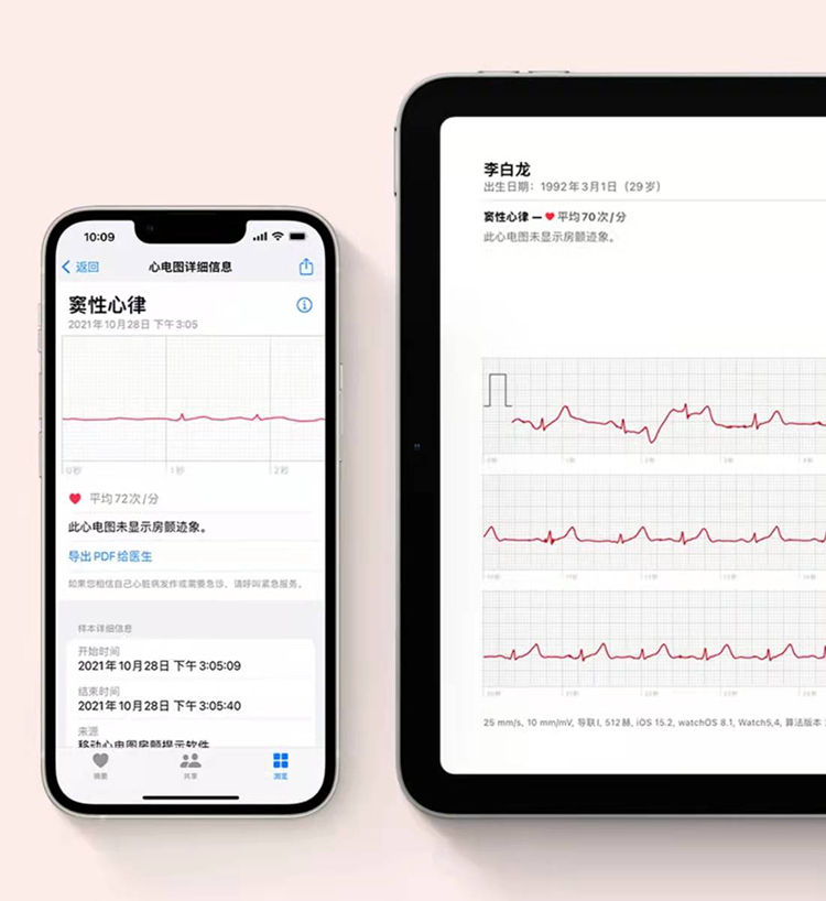 软件|苹果Apple Watch 国行ECG心电图功能正式上线，能帮助用户识别房颤