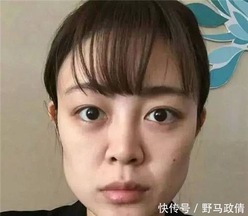 女孩子|3种被公认为“不忍直视”的脸型,神仙整容术也拯救不了你的颜值