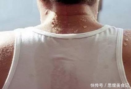 糖尿病人|糖尿病可以活多少年?提醒:睡觉时有4种表现,抓紧查一查血糖