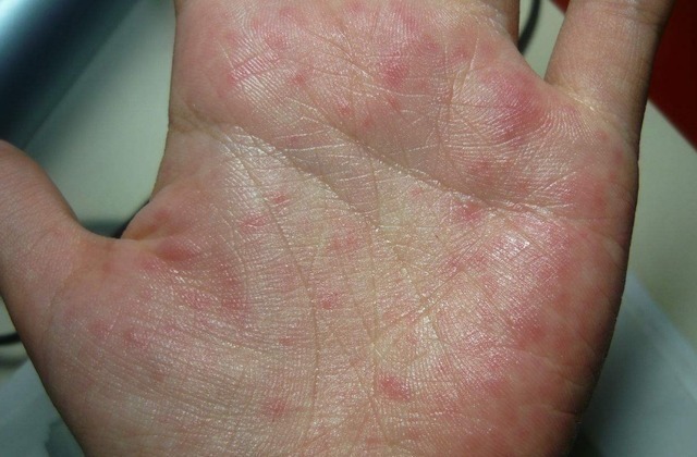 医生|消化科医生养胃很简单,3种“零食”,你若爱吃,胃自然好起来