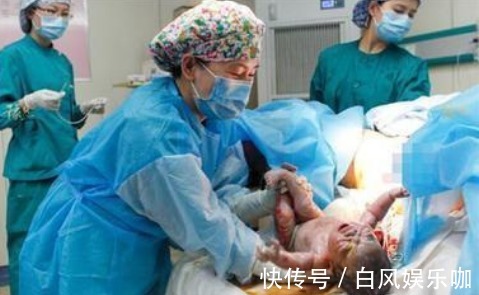 畸形|盼五年最终怀孕,大夫却说腹中儿是畸形,妈妈却任性生下惊喜宝宝