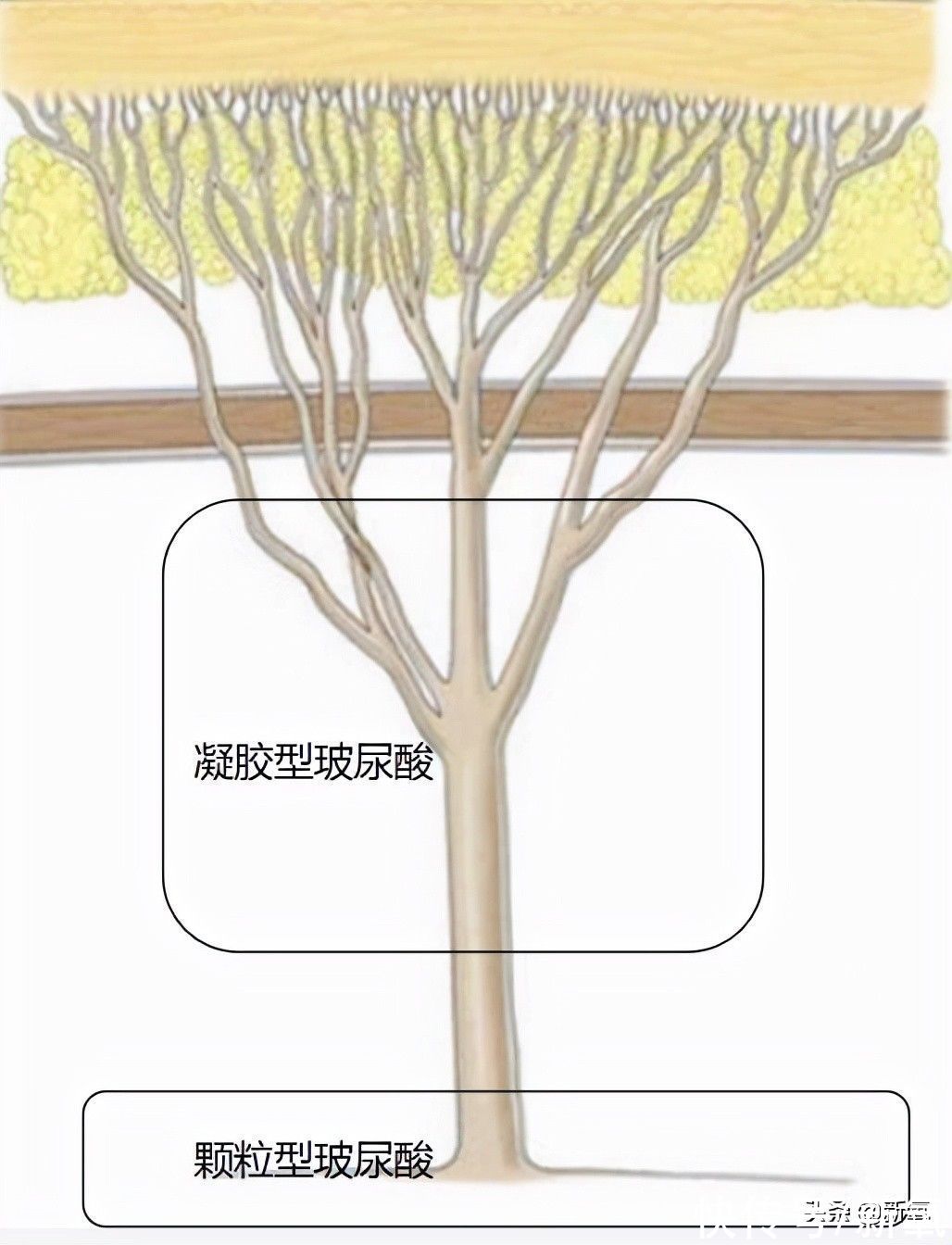 韧带|人生无常，大肠包小肠，腿精变肿精？