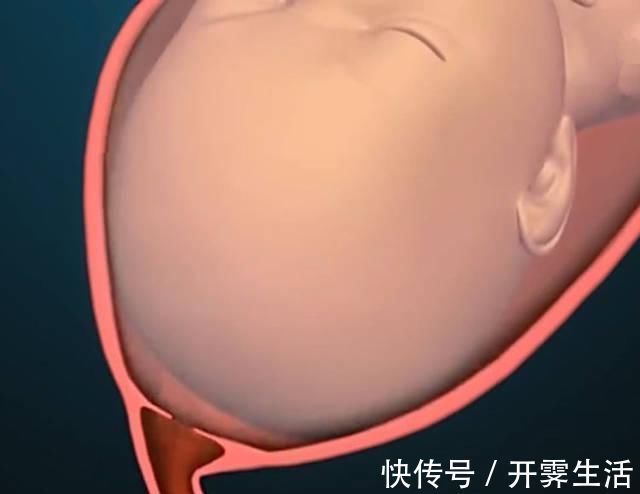 拉玛泽|顺产到底有多“疼”看到第3张图,也许你会明白