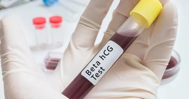 过程|试管流程中,哪个流程是最疼的