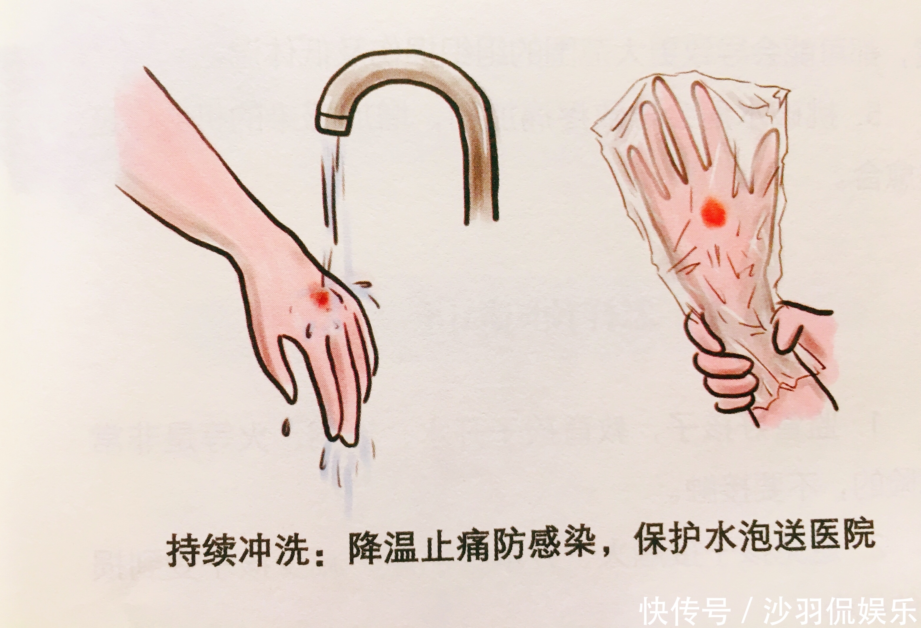 家长|夏季小心宝宝烧烫伤，教你正确急救法及如何预防，家长收藏学习