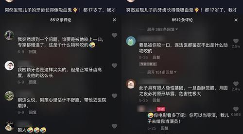尖牙|15岁男孩长出“尖牙”,妈妈亲手摸过后吐槽:养了个“吸血鬼”