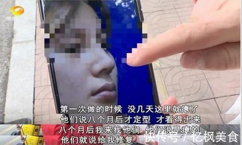 凹陷鼻 女子花60000整容,术后却整成“凹陷鼻”,找其理论主刀医生闭门不见