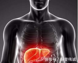 肝細胞|手掌出現的這個紋，居然是肝癌前兆肝臟發出的5個“求救”信號，別知道的太晚