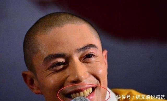 网民|我国“憋屈”的牙膏,因“价低”被嫌弃!网民:用后牙黄渐渐消失