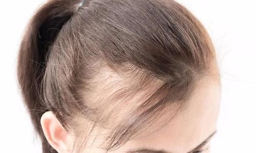 优质蛋白|你的身体，一旦出现这“5个”现象，是提醒你需要补充蛋白质了