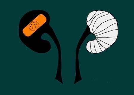 尿毒症的4个苗头，一旦发现它们，还请及时去医院就诊！