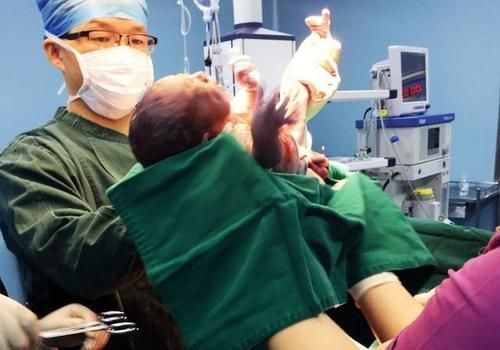 女大夫|生孩子总遇到男医生?产妇别觉得尴尬,对自己和宝宝有好处