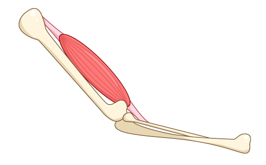折磨|常年折磨女性的腱鞘炎，是怎么产生的？如何治疗？告诉你详细方法