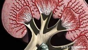 结石会|很多人碎完肾结石之后,还是感觉到很疼,这个时候应该怎么办?