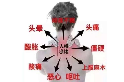 葛根|化解颈椎病的特效方，只有2味药，一补一通，谁用谁受益