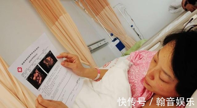 误区|孕期要做四维彩超,四维彩超的这些误区和认识,孕妈妈早知道早好