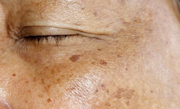 女性朋友|子宫好不好要看脸,如果脸上出现5个变化,说明子宫不健康