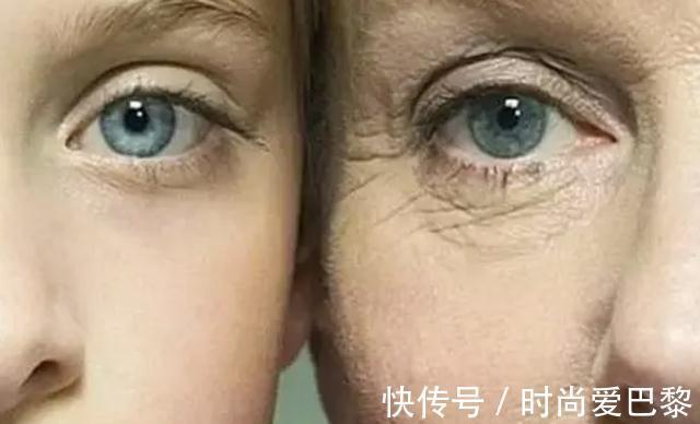 冠状动脉|多走路能降血脂？医生提醒：日常多吃这4物，或比走路效果好