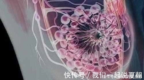 内衣|女大学生胸部常常瘙痒，剪开内衣后，真是不敢相信自己的眼睛