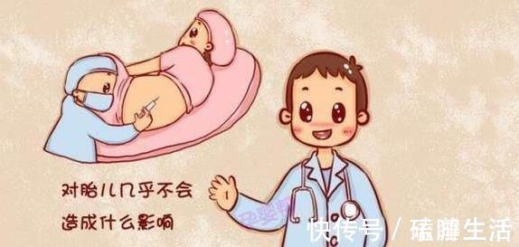 产后抑郁|什么是“无痛分娩”顺产时,到底要不要打“无痛分娩针”